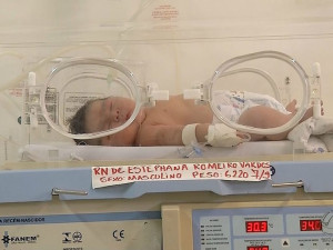 Bebê nasceu com dobro de peso de um recém-nascido e 9 cm a mais