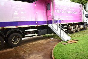 Carreta do Hospital do Câncer atende  na CAM e desafoga lista de espera