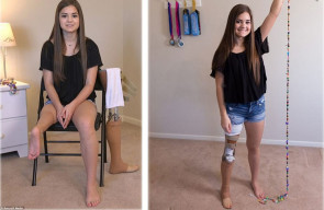 Superação  e muita força de vontade essa é a historia de Gabi Shull