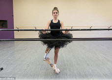 Garota que teve perna amputada, continua a dançar balé