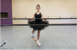 Garota que teve perna amputada, continua a dançar balé