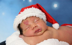 Bebê nasce com marca de nascença com formato de coração