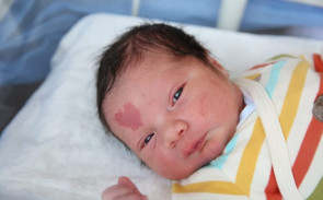 Bebê nasce com marca de nascença com formato de coração