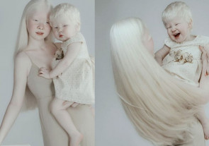 Irmãs albinas com 12 anos de diferença surpreendem por beleza