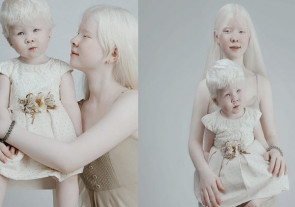 Irmãs albinas com 12 anos de diferença surpreendem por beleza