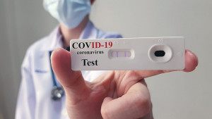 Testes rápidos para Covid-19 em farmácias foi autorizada pela Anvisa este ano