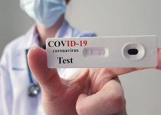 Testes rápidos para Covid-19 em farmácias foi autorizada pela Anvisa este ano