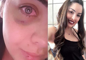 Danielle Nunes agradeceu no Instagram pela córnea doada que a fez volta a enxergar