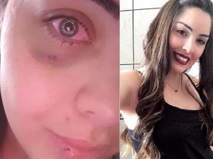 Danielle Nunes agradeceu no Instagram pela córnea doada que a fez volta a enxergar