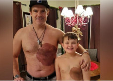 Derek tatuou a mesma marca de nascença do filho para incentivá-lo a gostar do corpo