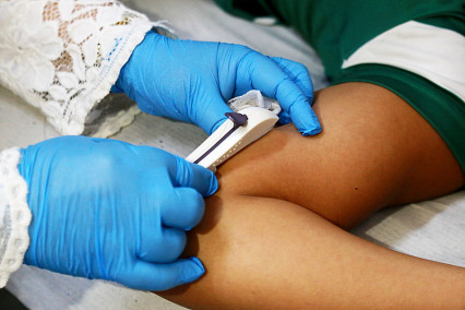 Prefeitura cria Comissão de Métodos Contraceptivos Reversíveis de Longa Duração