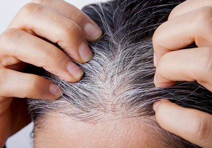 Pesquisa brasileira descobre substância capaz de reverter de vez os cabelos brancos